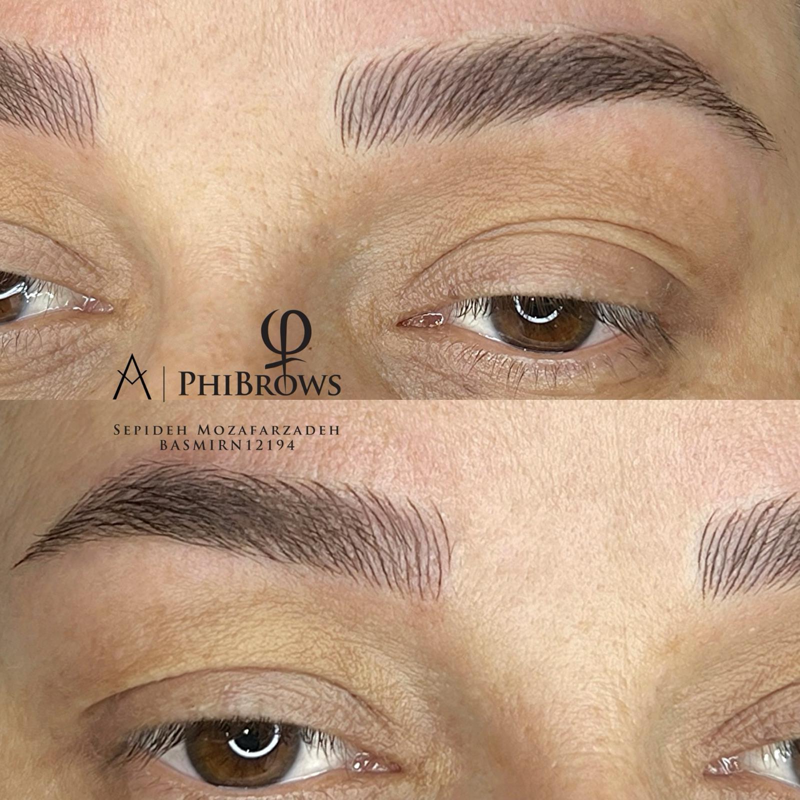 Eyebrows Microneedling result
